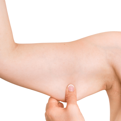 Thalassa - Flacidez do Corpo